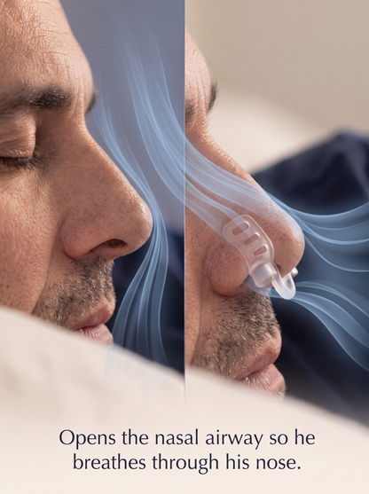QuietNights™ Nasal Dilator